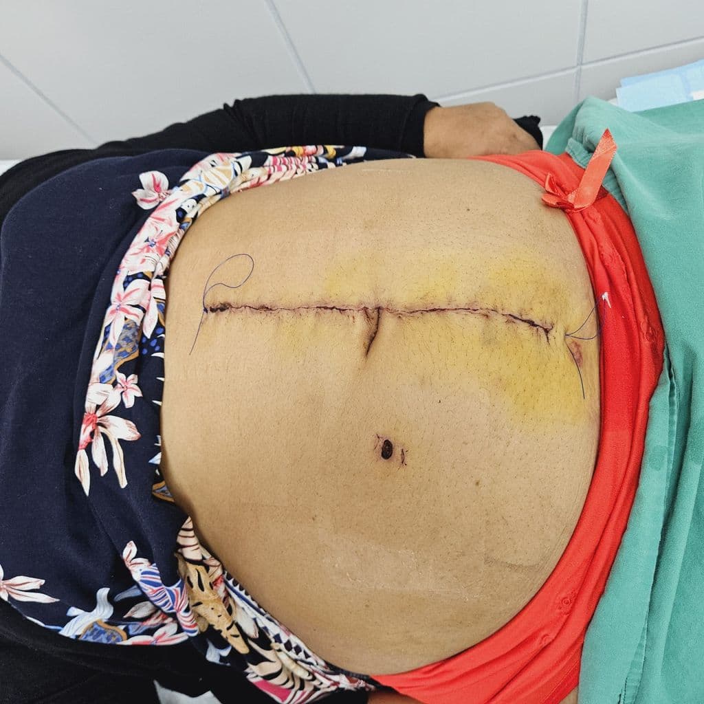 Woman rejects settlement over botched dental procedure