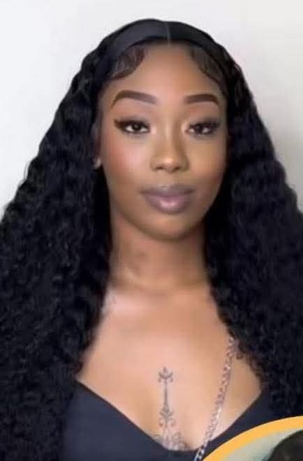 Acid attack victim: I can’t forgive my attackers