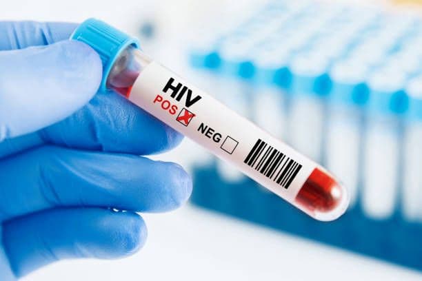 Health Ministry to expand HIV testing push in 2026