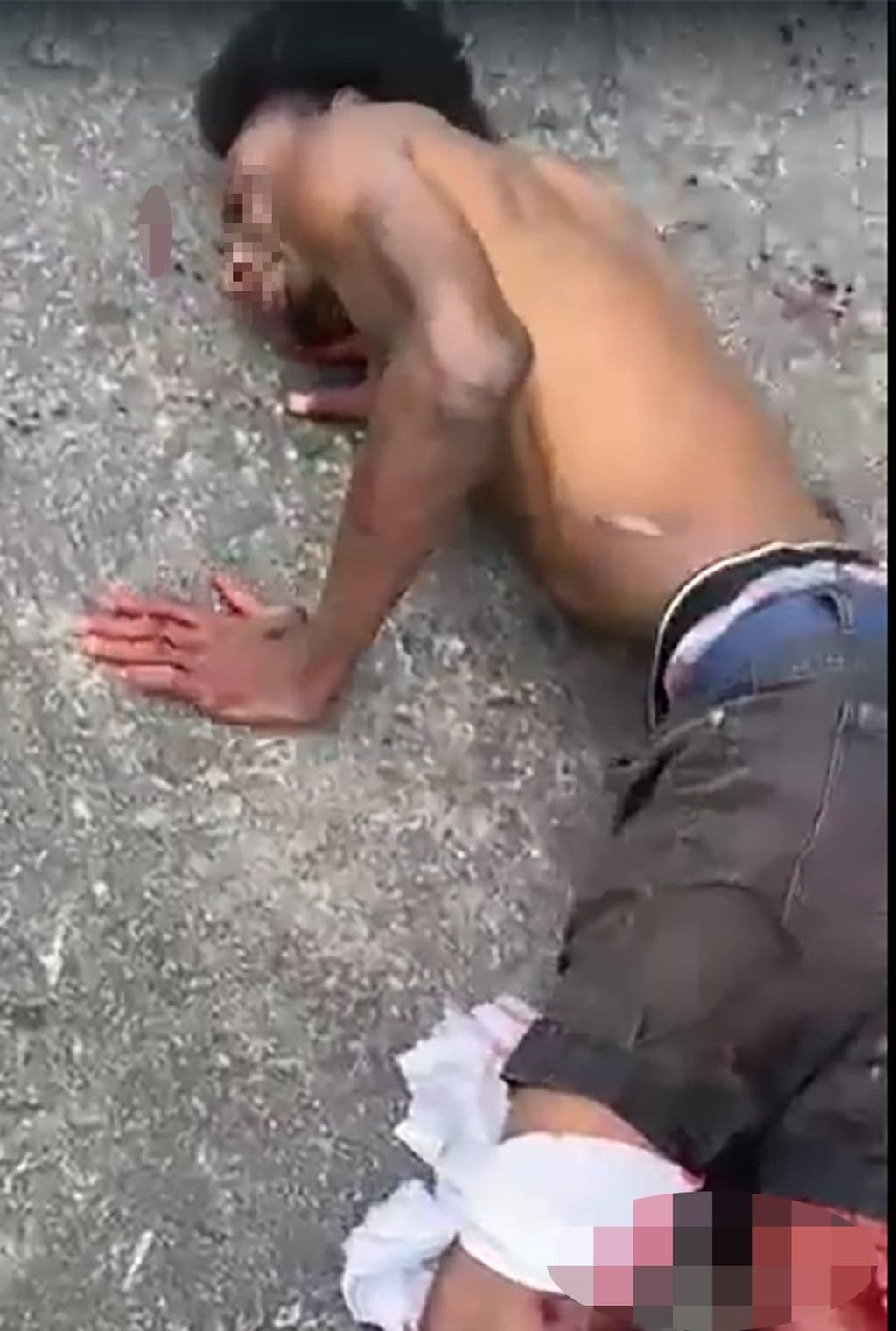 Belmont man shot in both legs