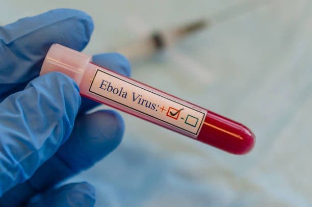 Gonzales calls for Ebola preparedness plan