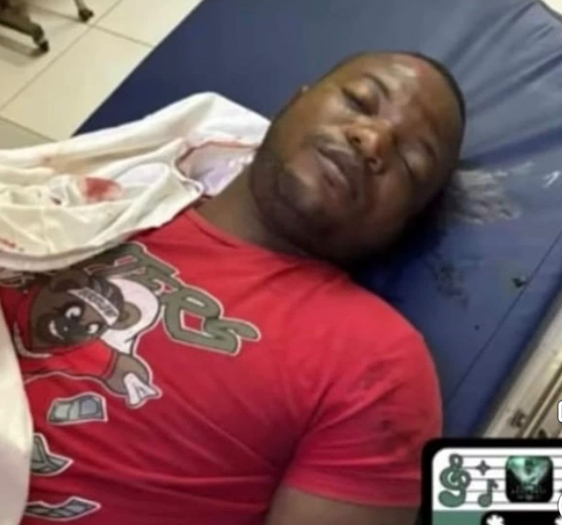 Butcher dies, teen injured in Corentyne motorcycle smash up
