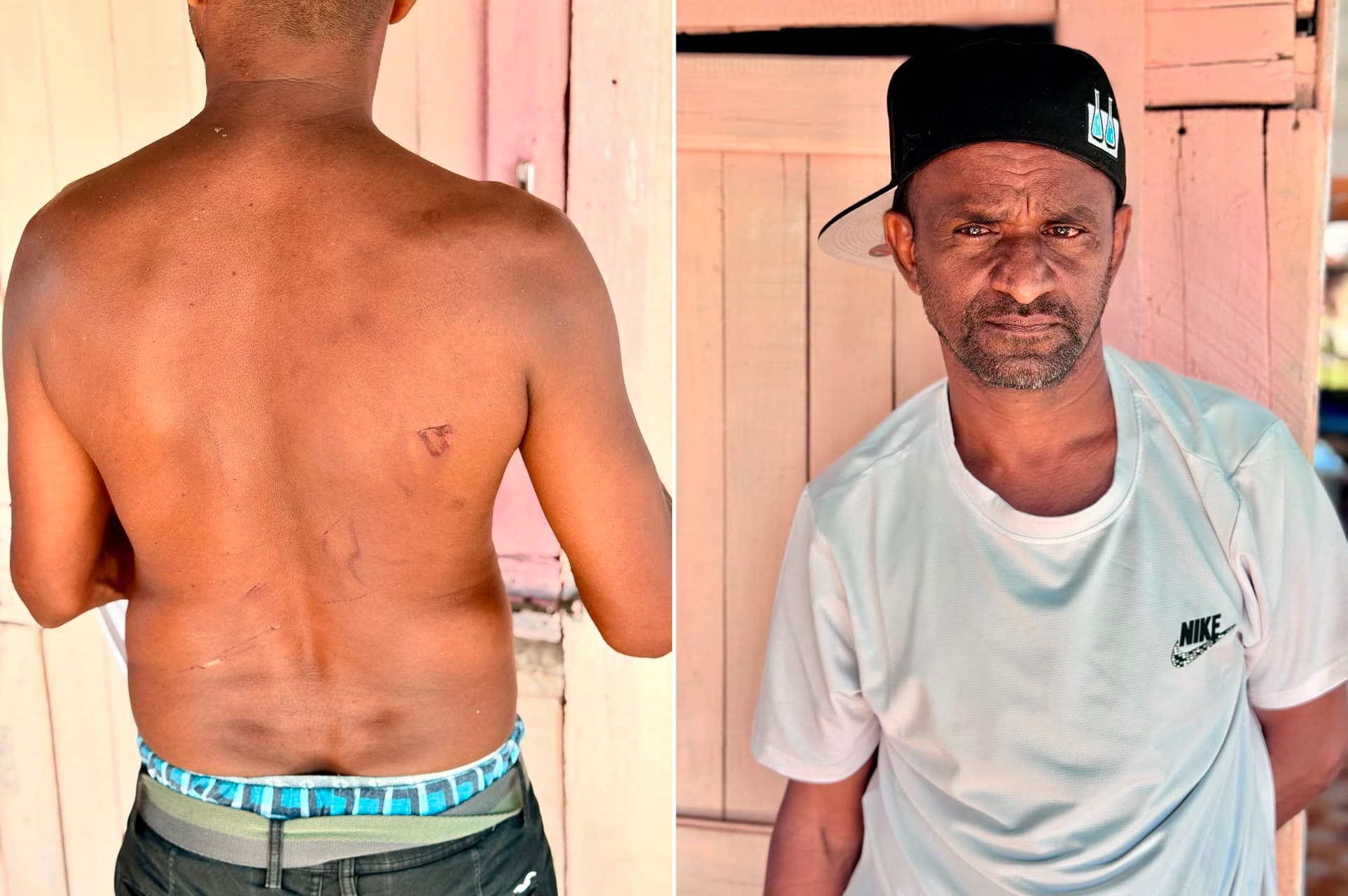 Corentyne family beaten and robbed of millions
