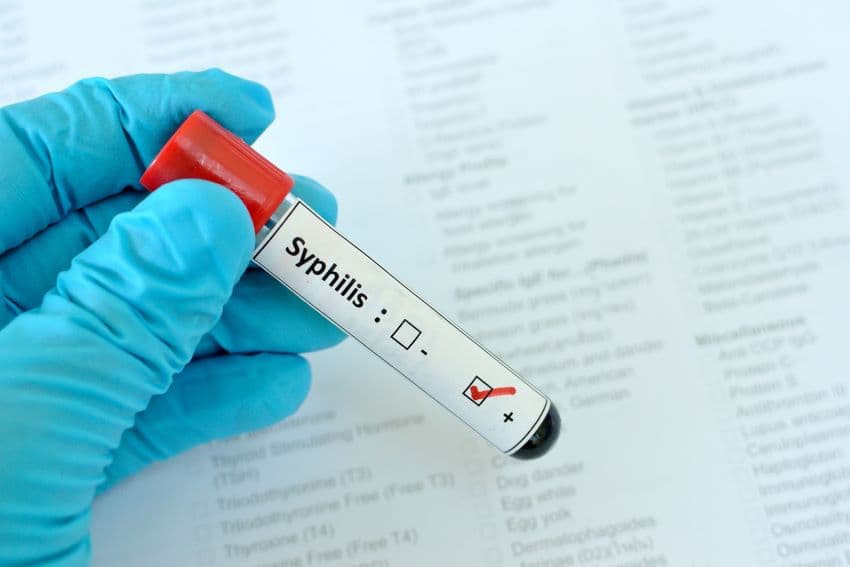 Bajans urged to get tested as syphilis cases rise