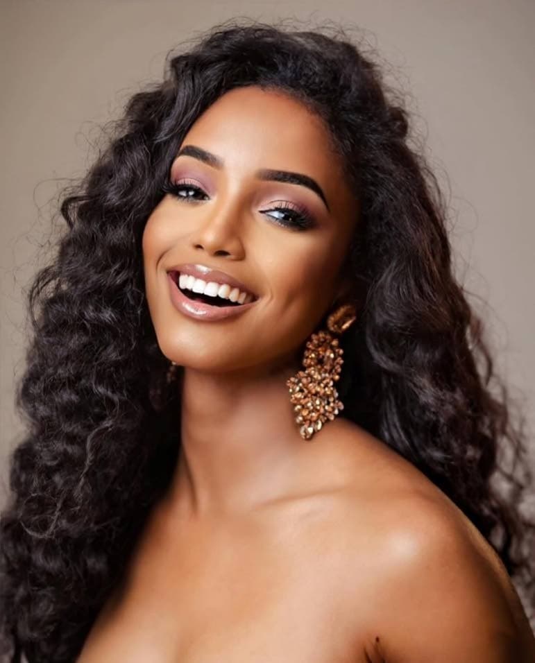 Miss Universe Jamaica makes first public appearance since fall in Thailand