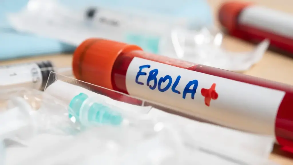 Jamaica free of Ebola cases, eight travellers placed in quarantine — Health Ministry